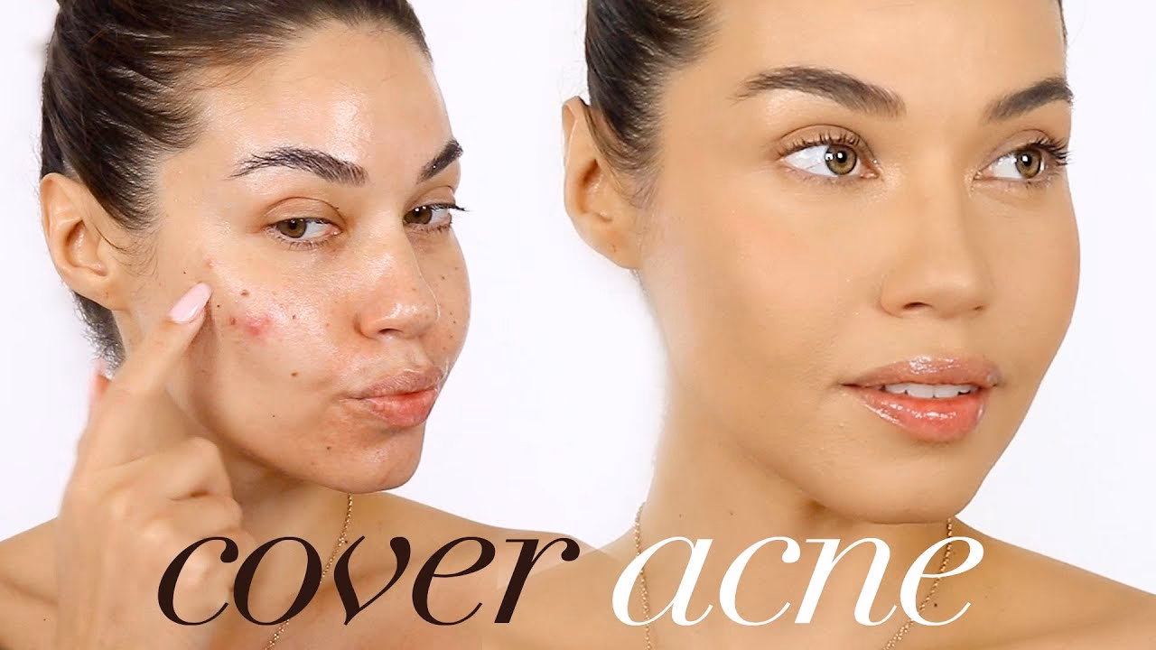 What makeup is best for covering up acne?