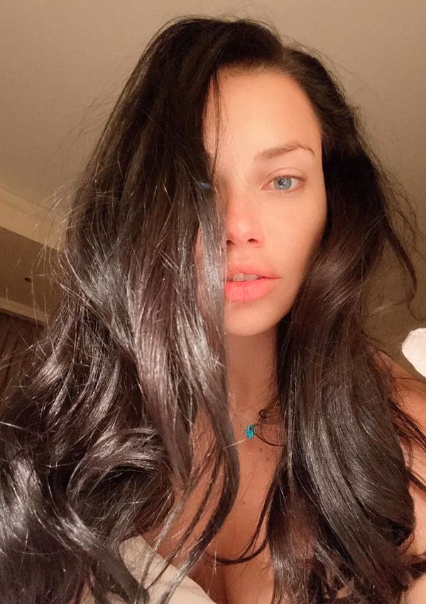 ¿Por qué cambió tanto el rostro de Adriana Lima?