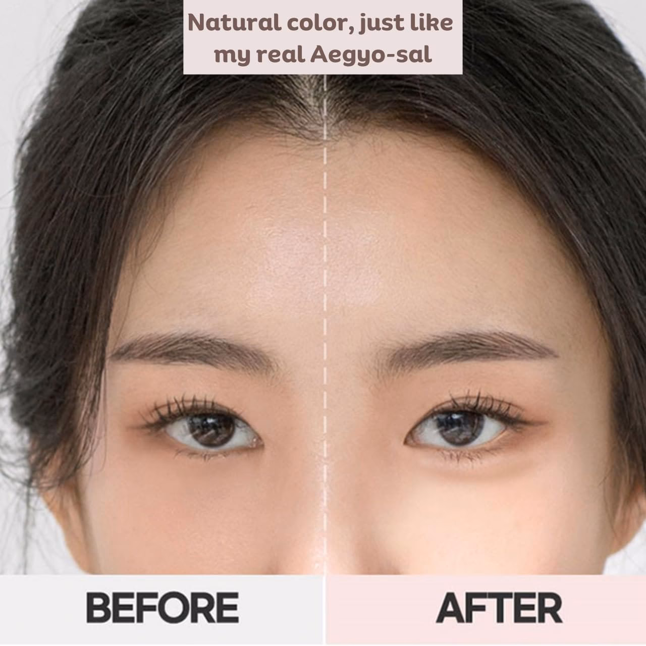 Can aegyo sal be natural?