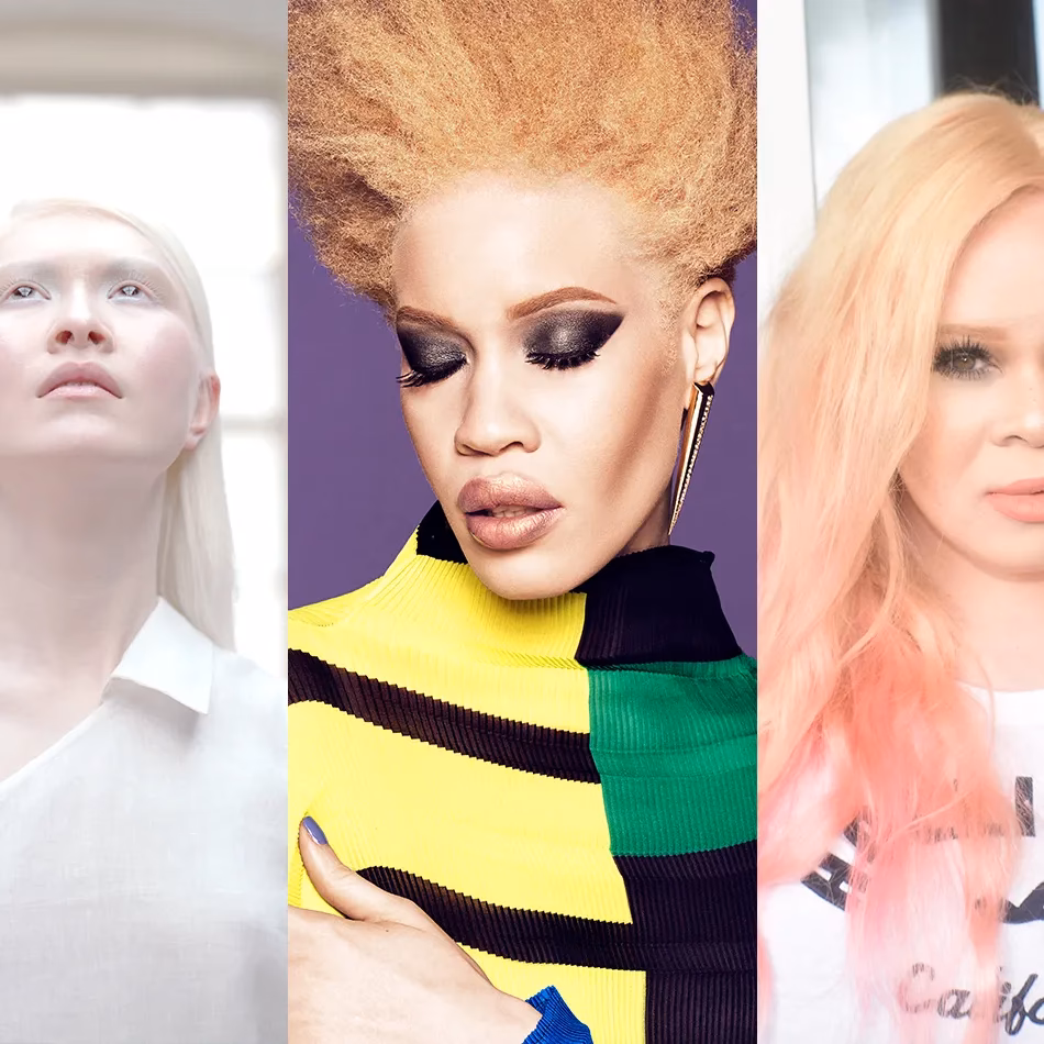 Can an albino wear makeup?