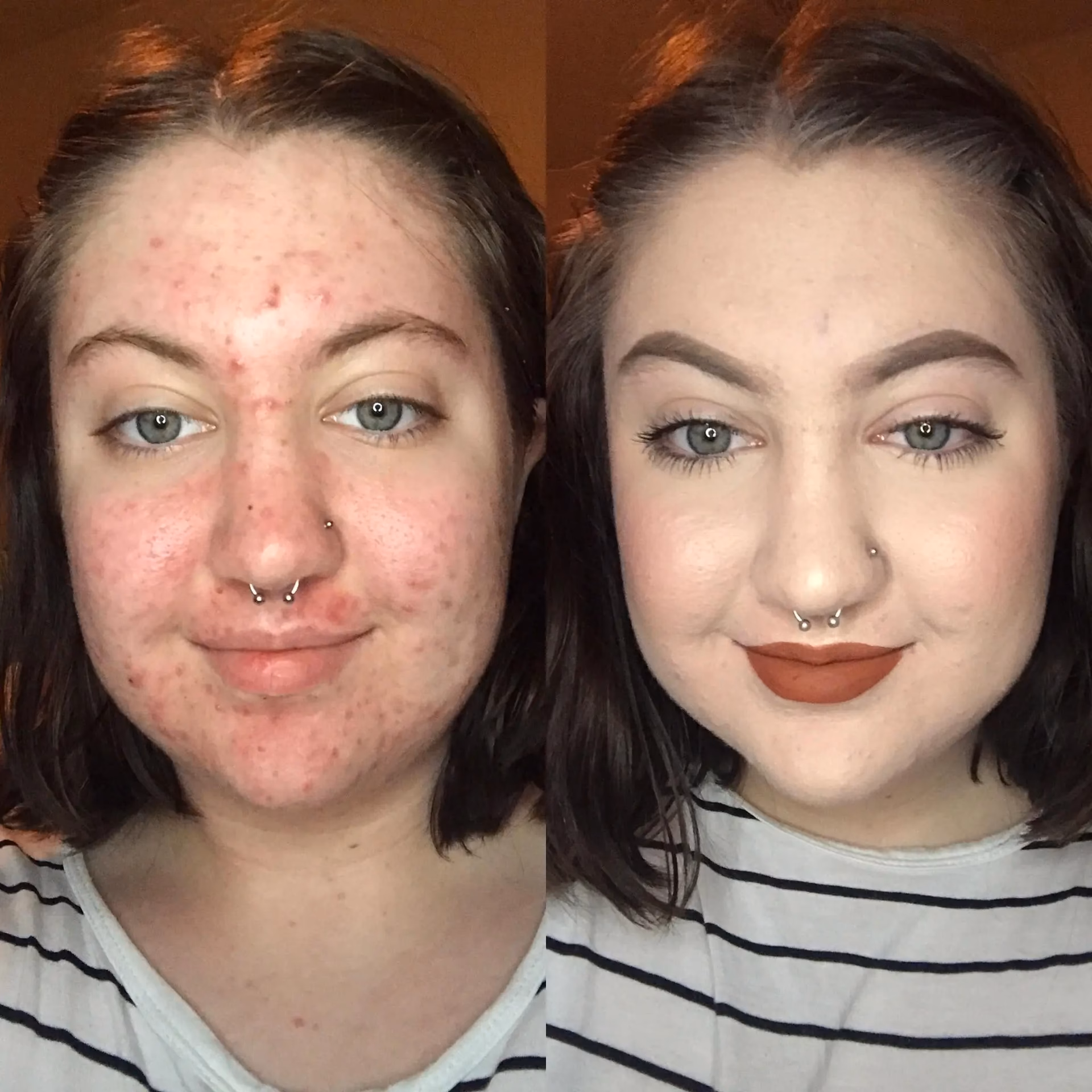 What are the little bumps after makeup?