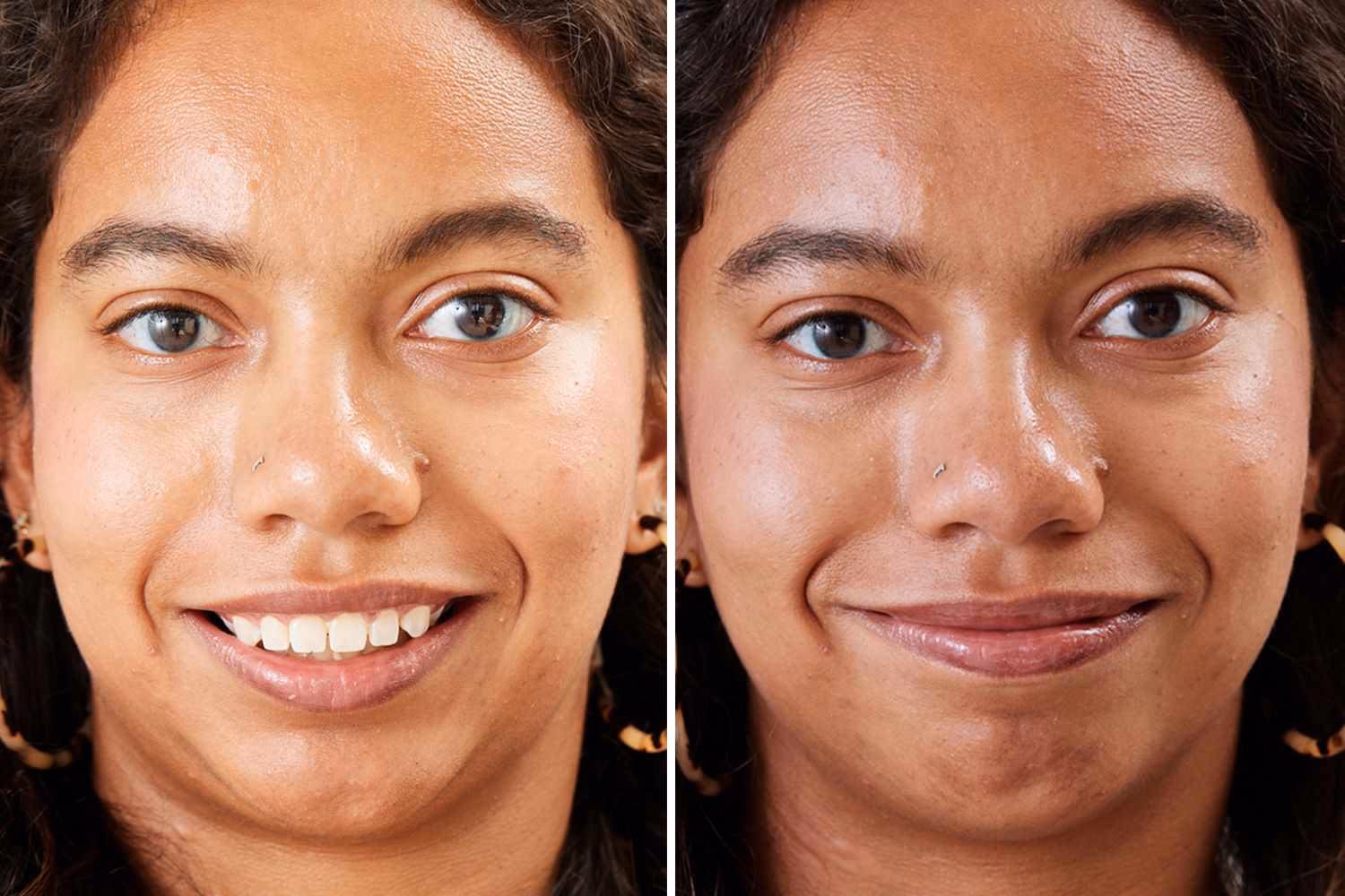 What is the best for fuller lips?