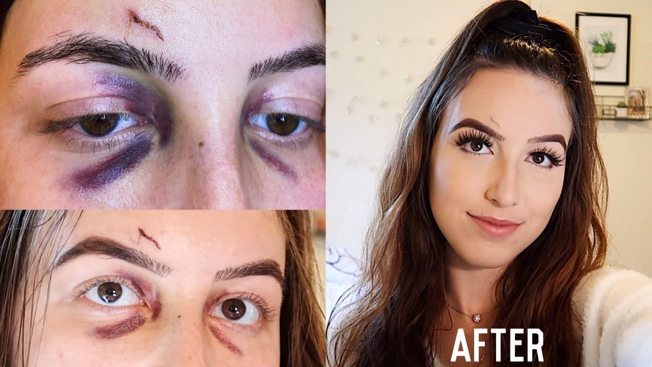 What makeup is best for black eyes?