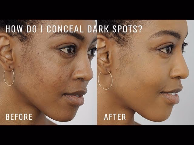 How to cover dark spots on African American skin?