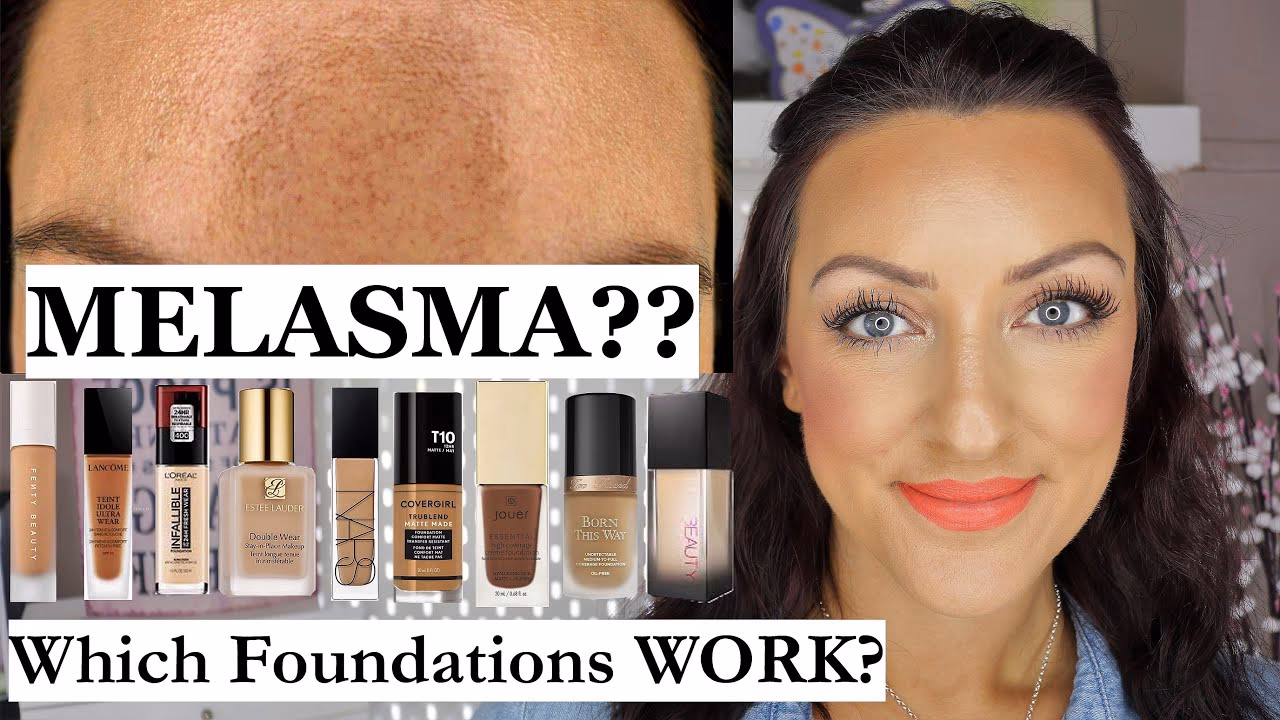 What color concealer is best for melasma?