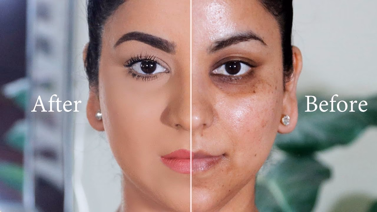How to hide uneven skin tone by makeup?