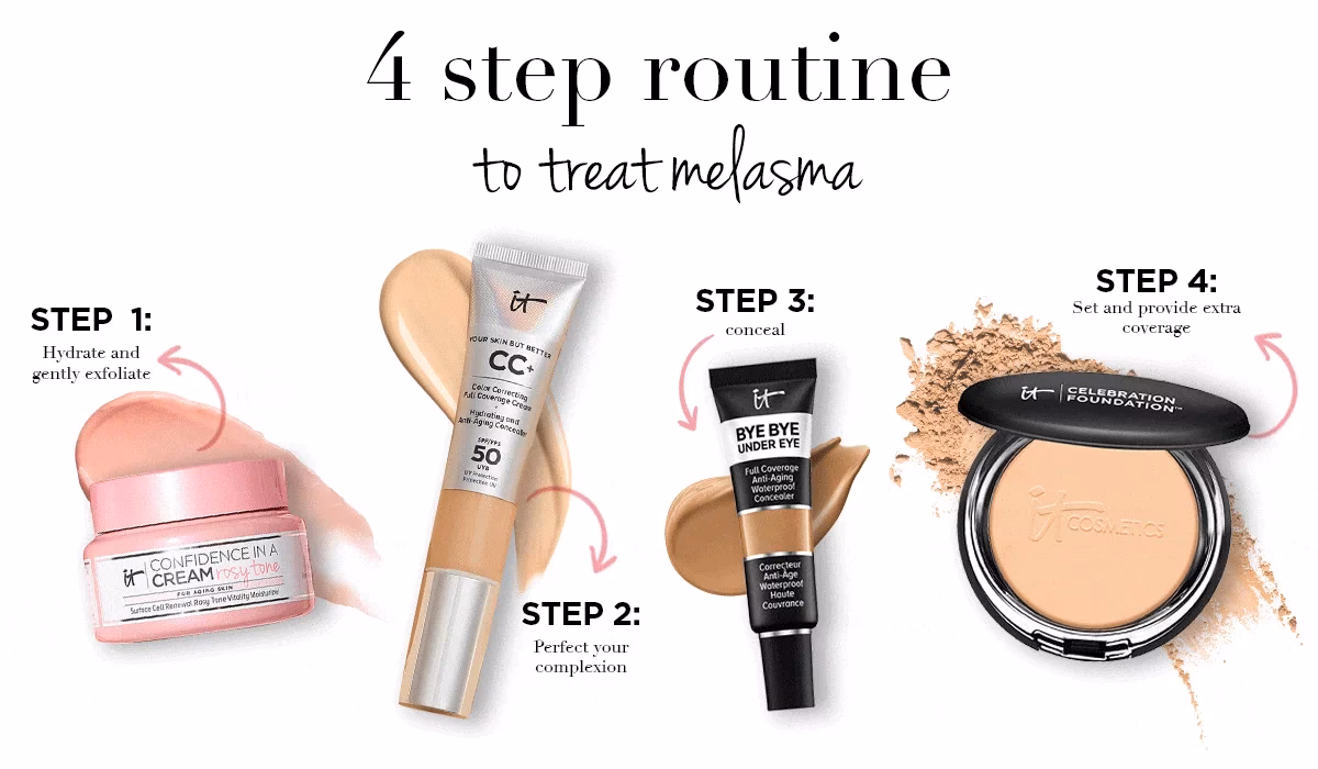 What color concealer is best for melasma?