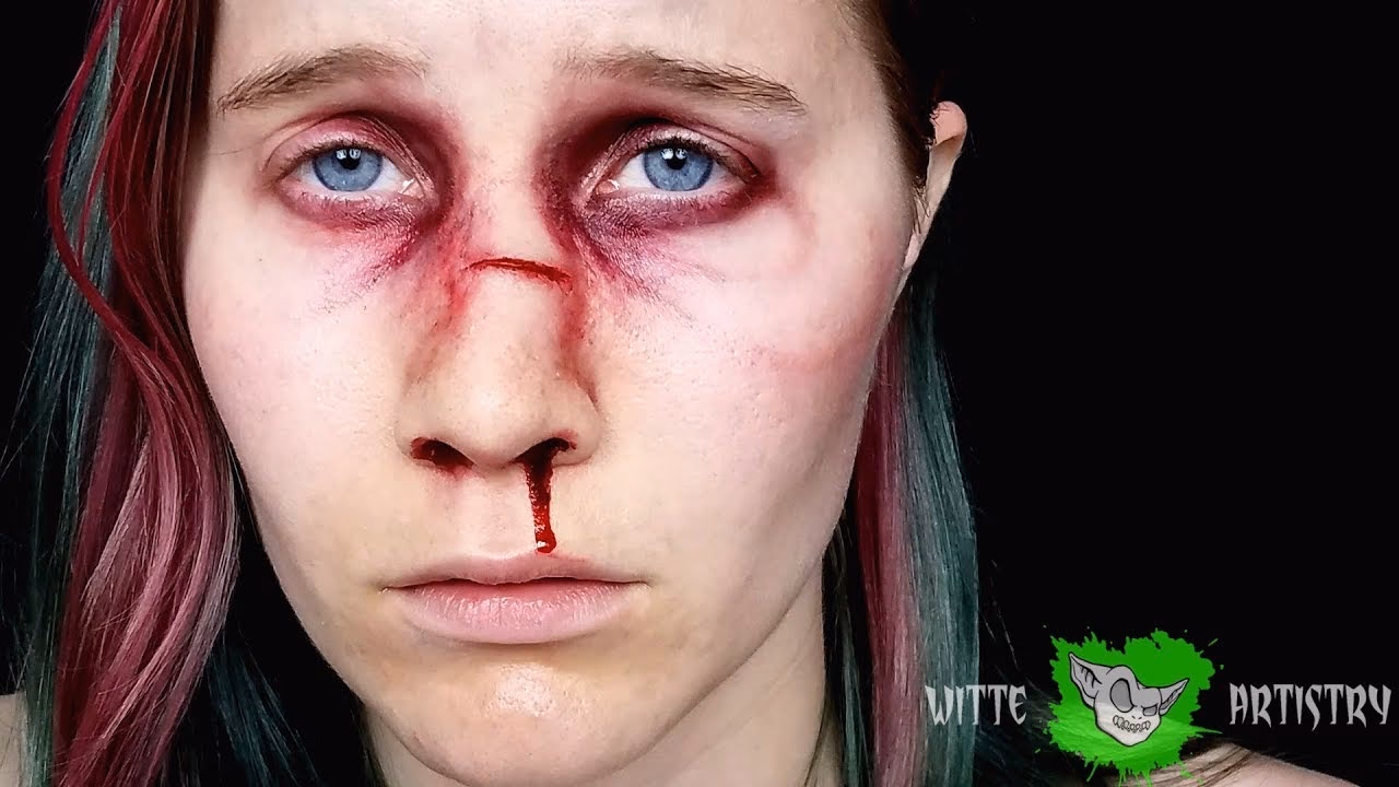 Is it okay to let a broken nose heal on its own?