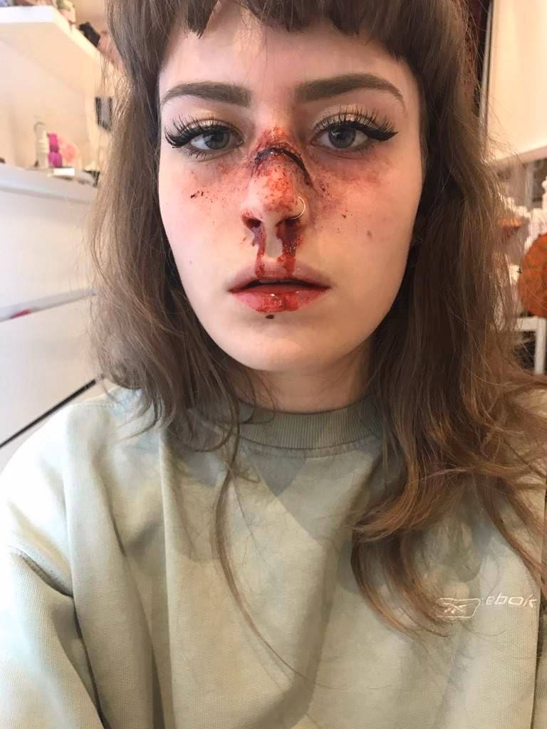 Should I go to urgent care or er for a broken nose?