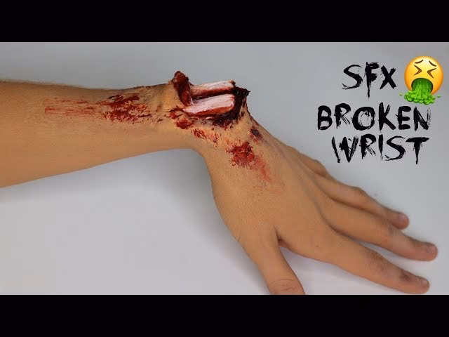 How do you dress a broken wrist?