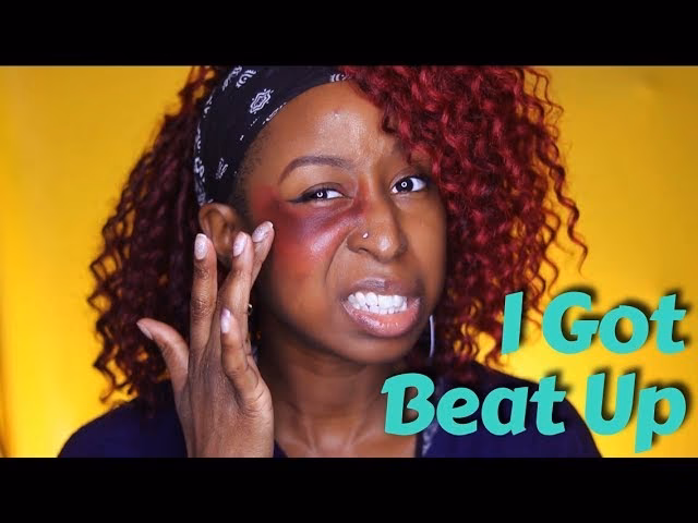 How to disguise bruises on face?