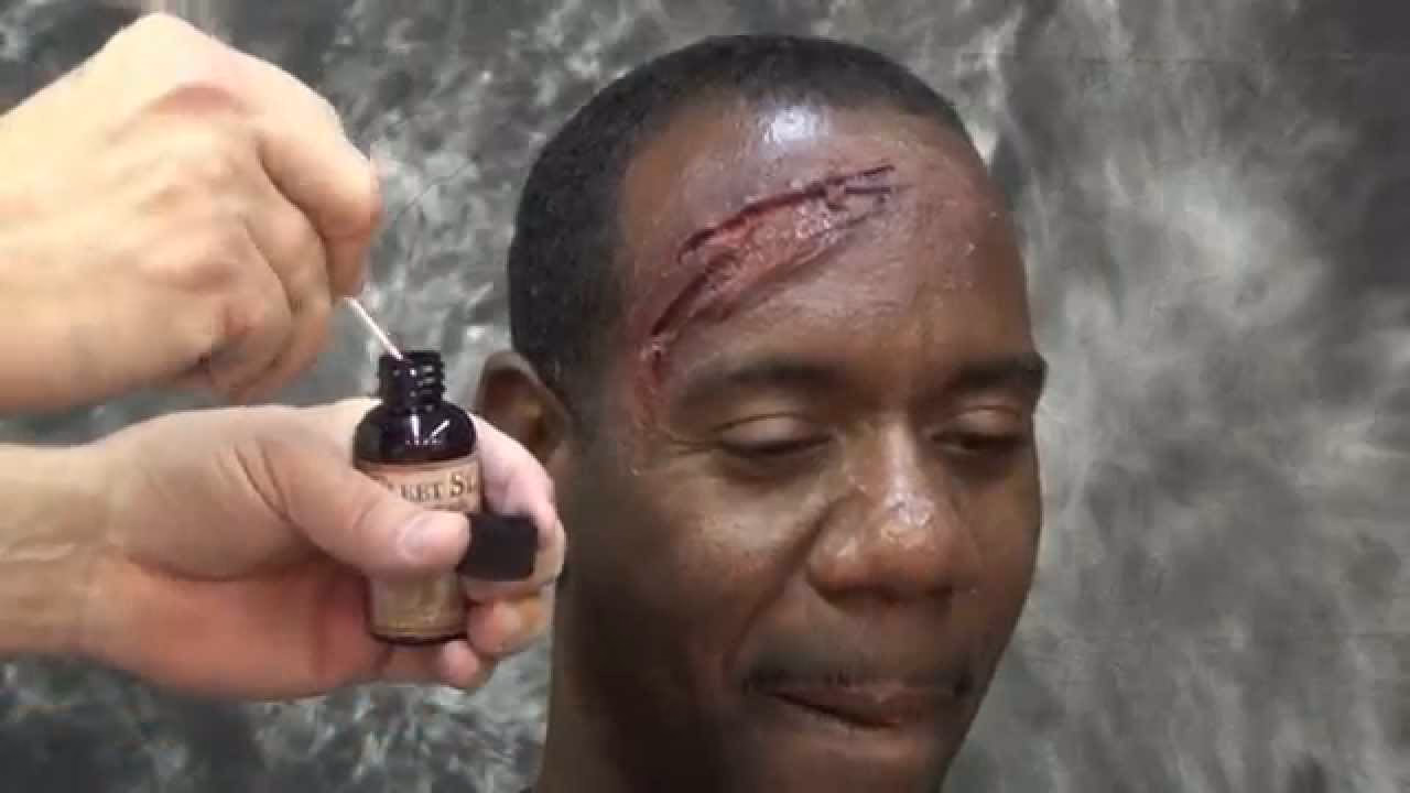 How do bruises show up on dark skin?