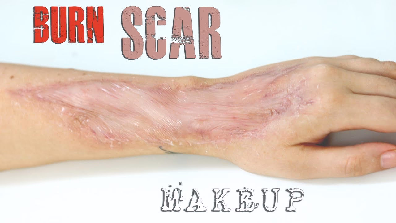 Can you put makeup on a burn scar?