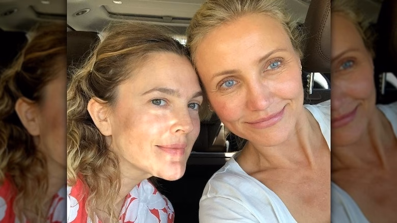 What skin condition does Cameron Diaz have?