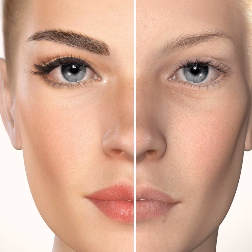 How much does skin camouflage cost?