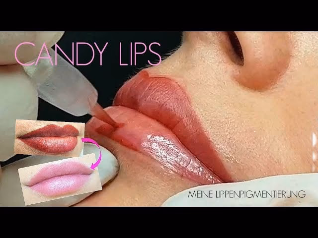 Do candy lips work?