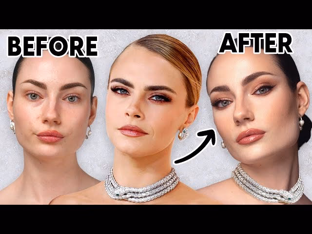 What is Cara Delevingne diagnosed with?