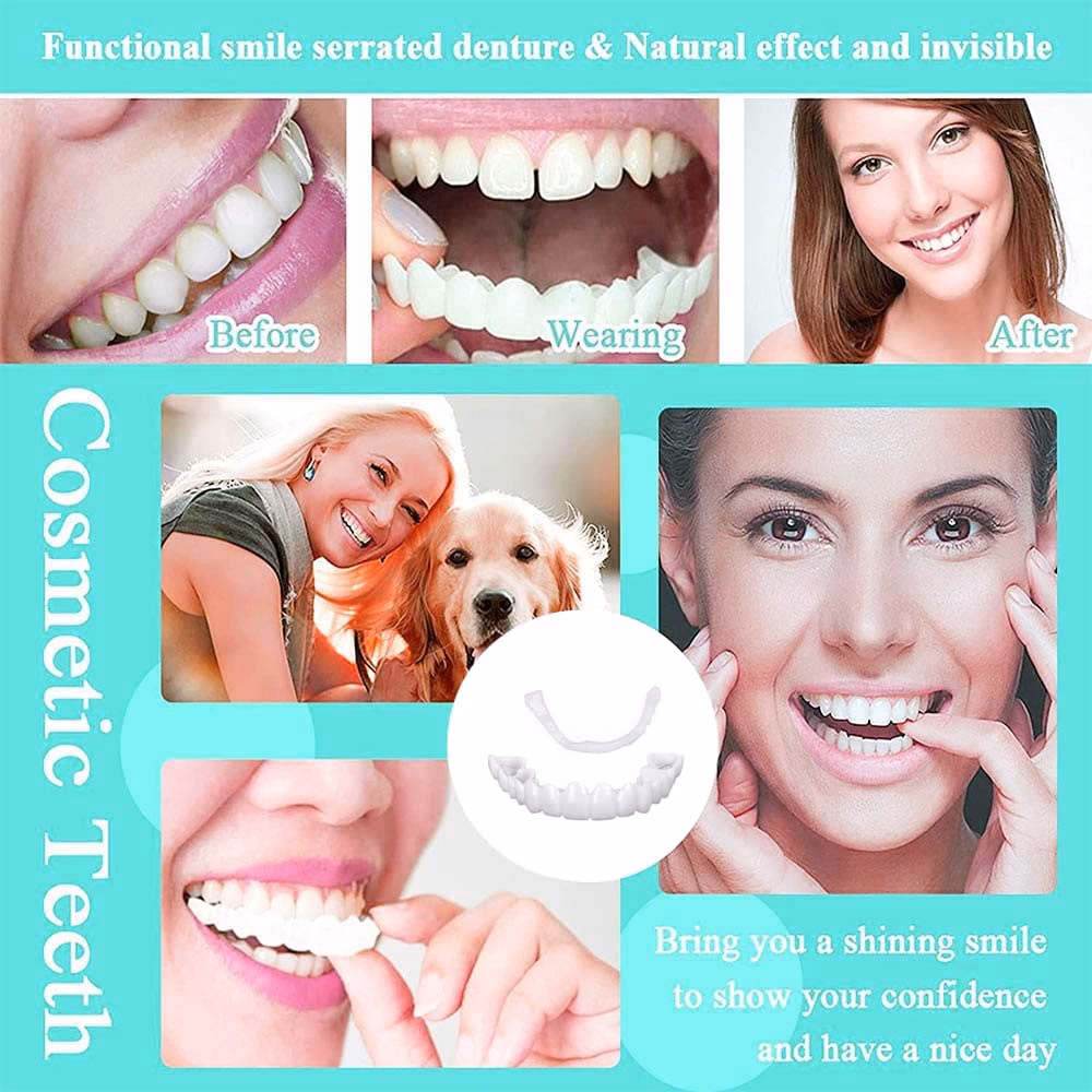 ¿Cuál es el costo de una carilla dental?