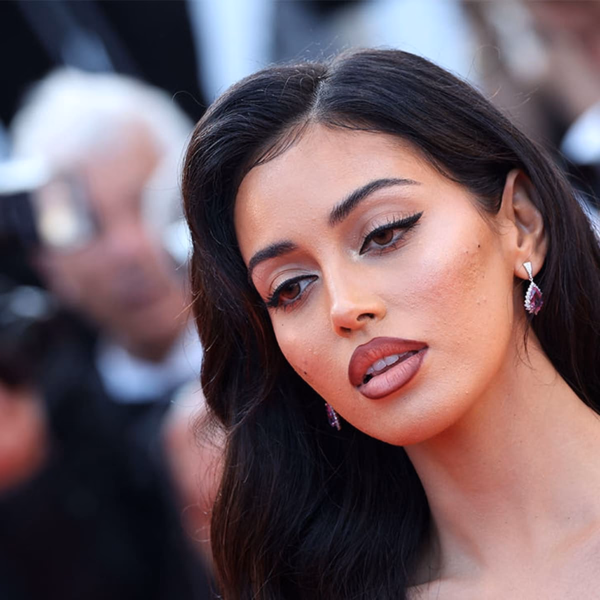 Does Cindy Kimberly have fillers?