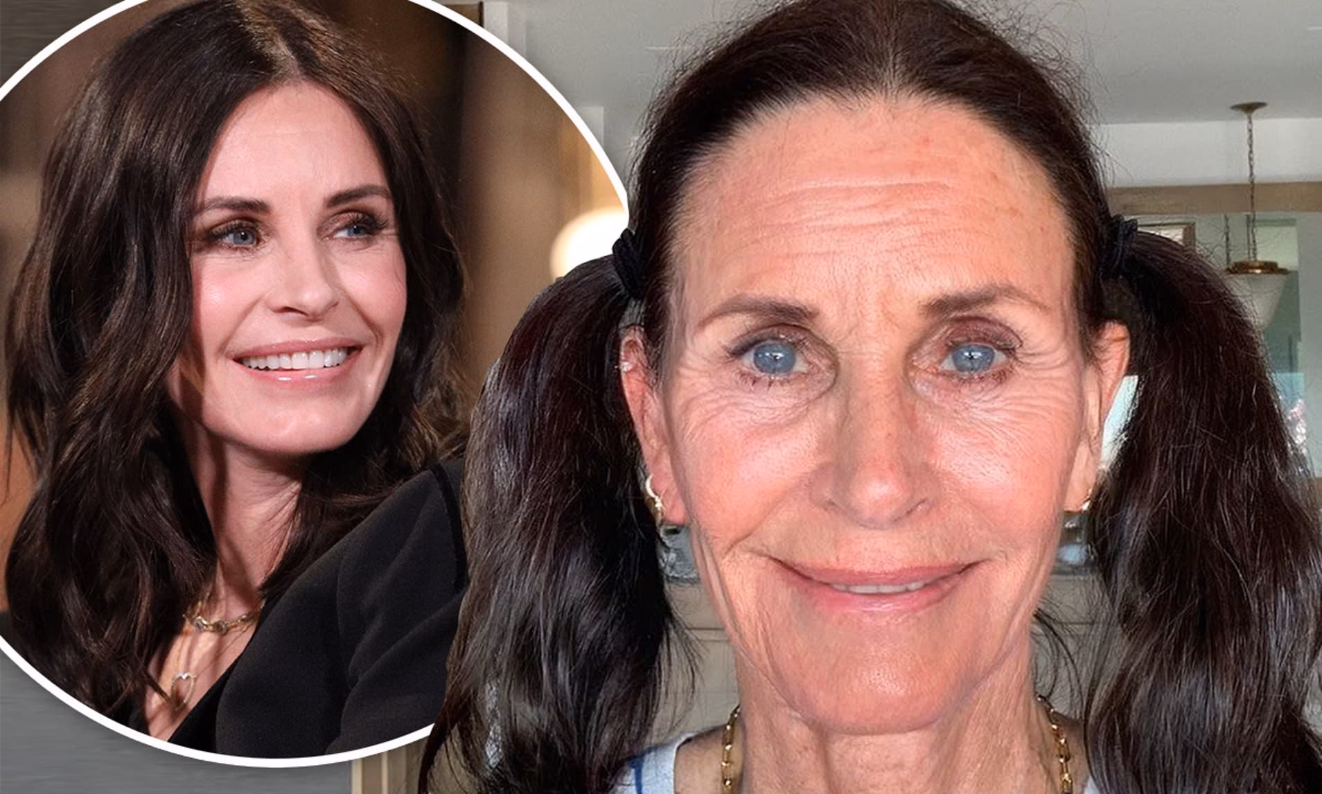 What condition does Courtney Cox have?