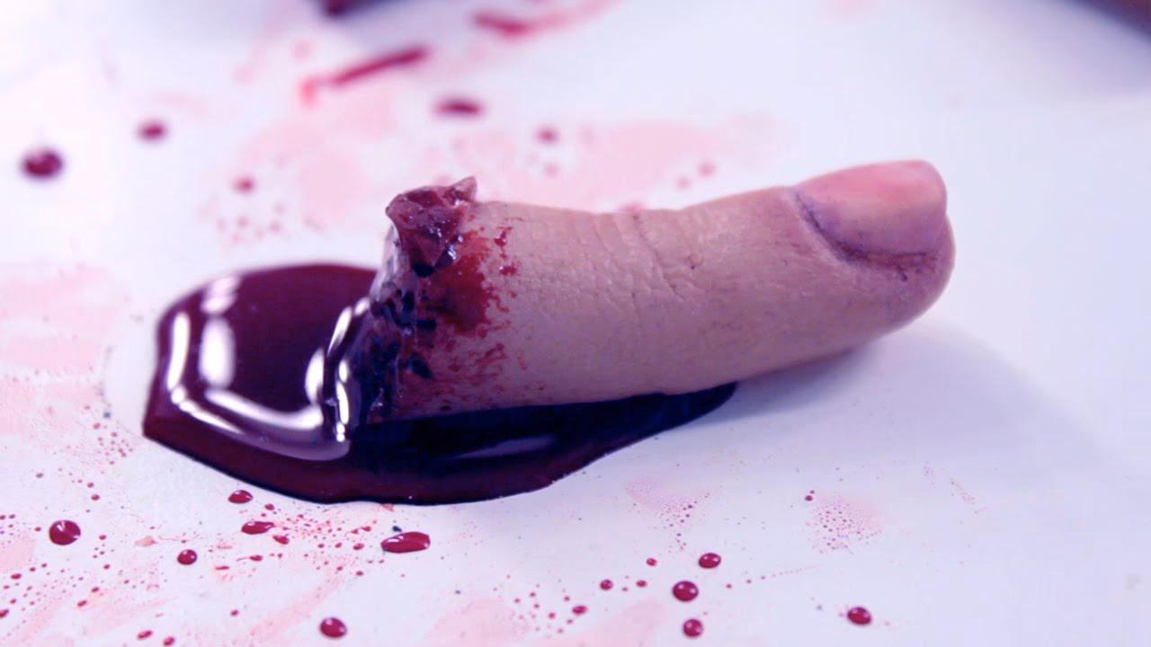 ¿Cómo rehabilitar un dedo amputado?