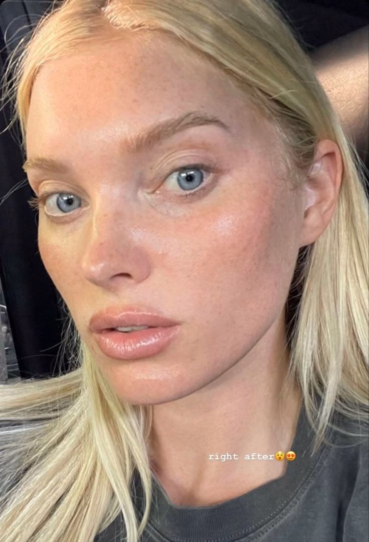 Is Elsa Hosk a supermodel?