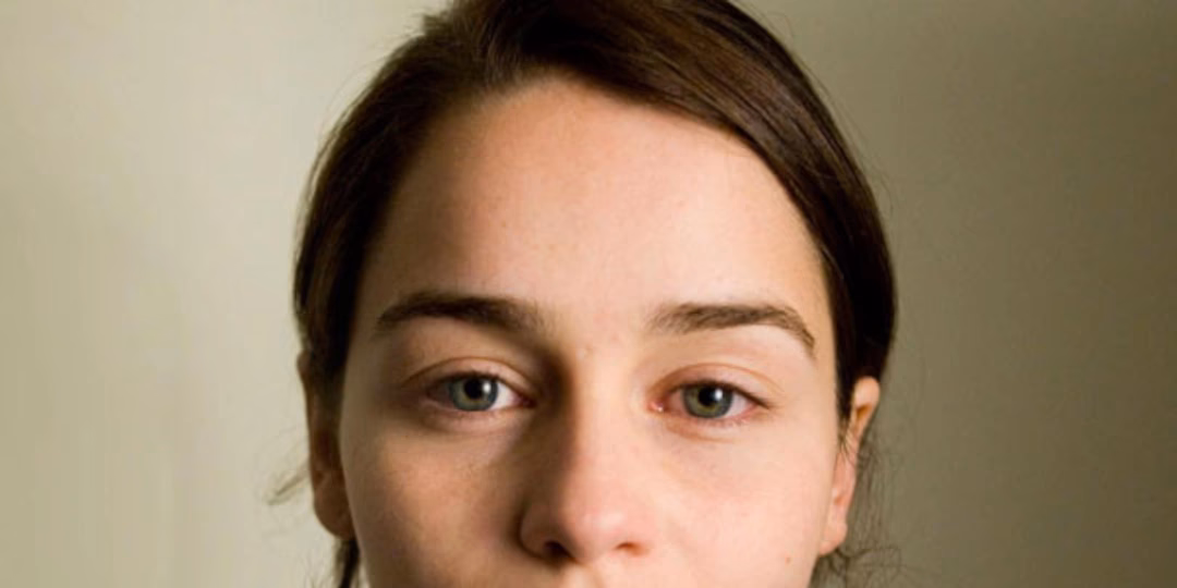 Has Emilia Clarke had cosmetic surgery?