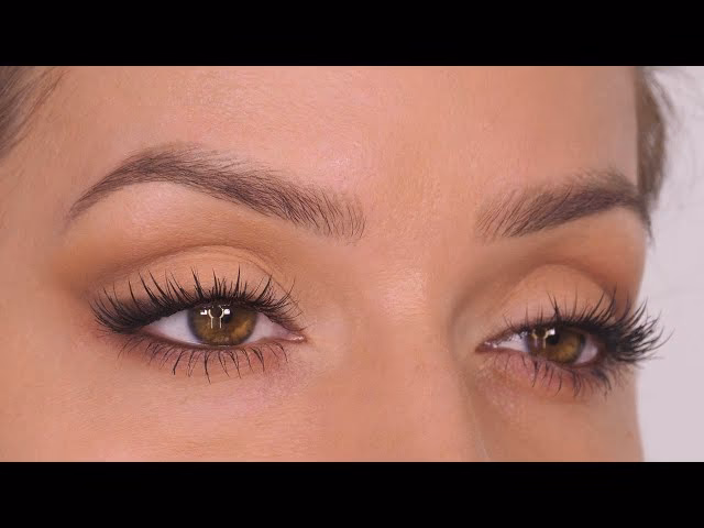 What are the fat deposits under the eye contour?