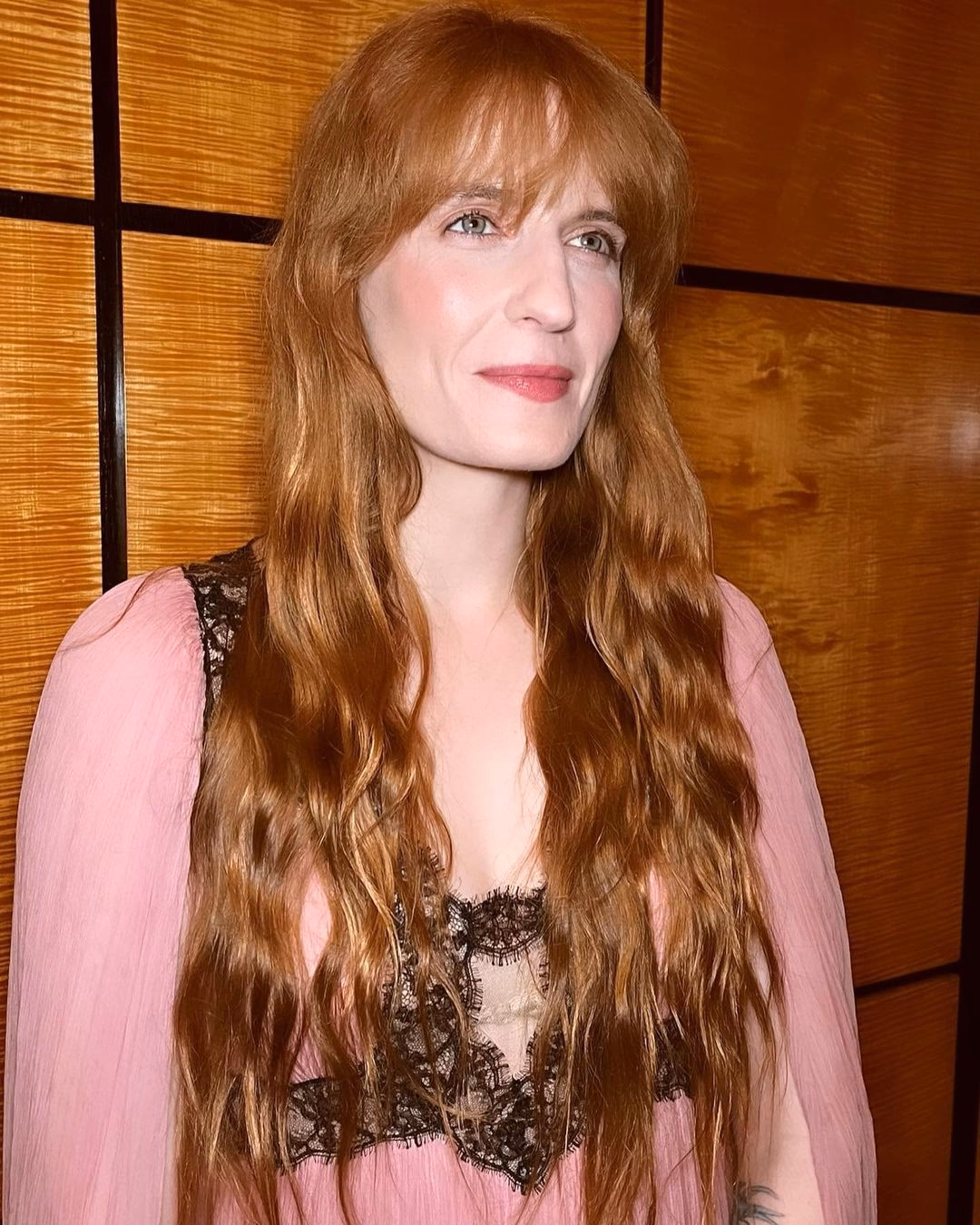 What condition does Florence Welch have?