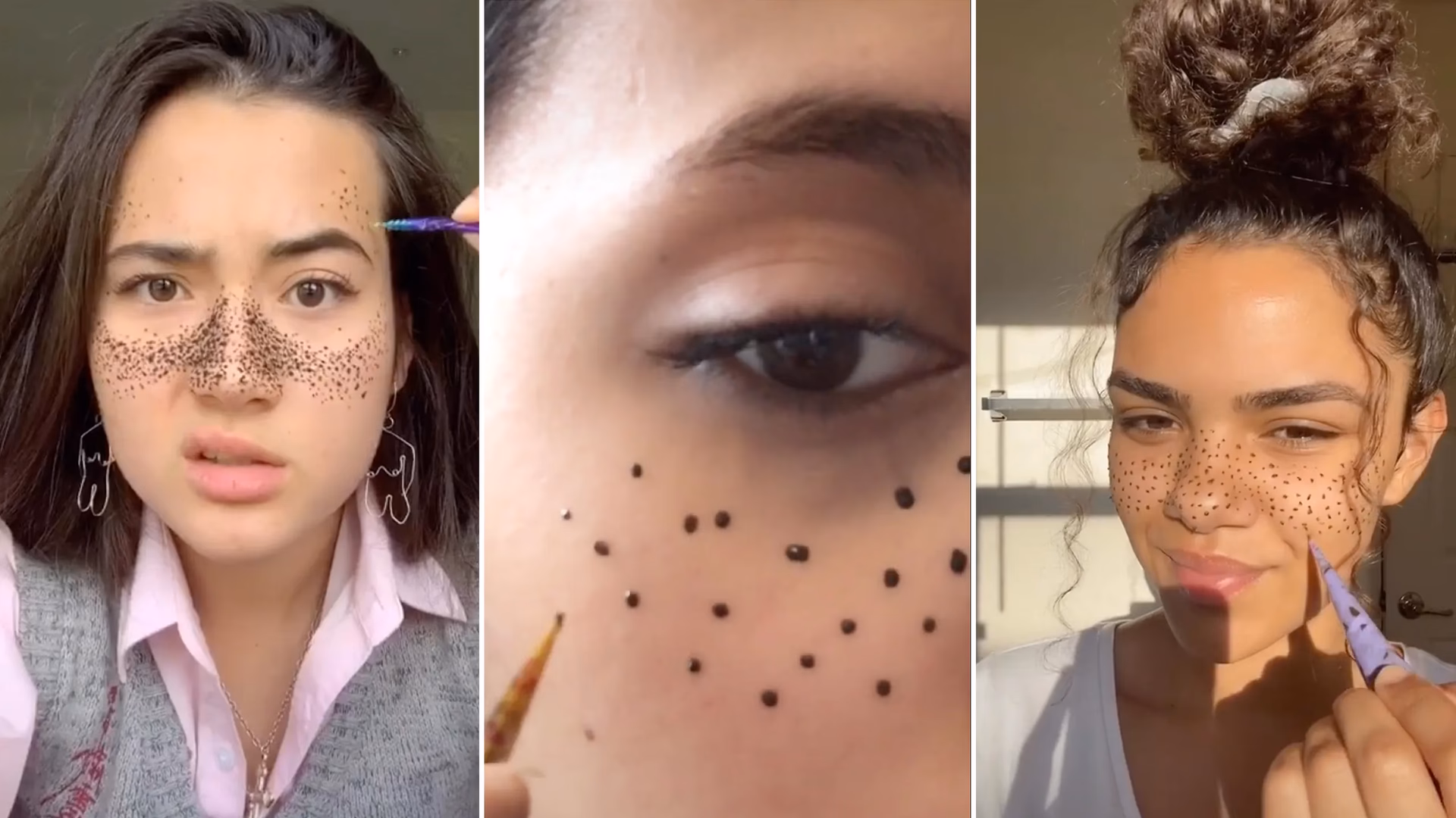 When did freckles become trendy?