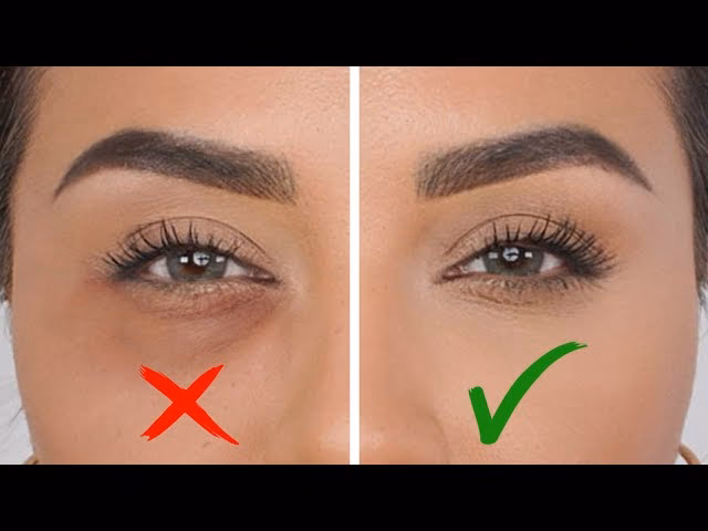 Is there makeup that actually covers dark circles?