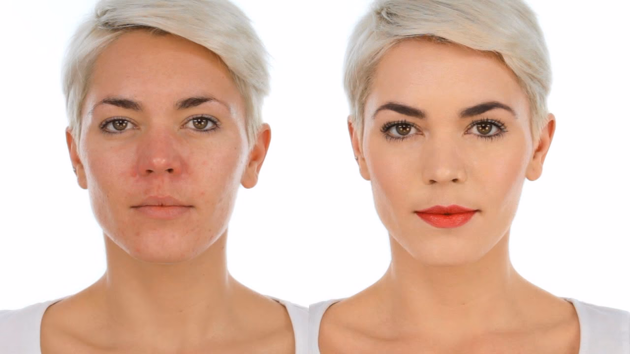 What is the fastest way to get rid of redness on the face?