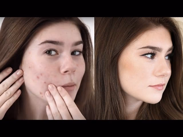 Is it possible to cover facial hair with makeup?