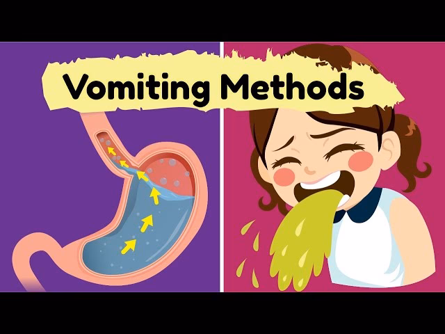 Should I throw up if I need to throw up?