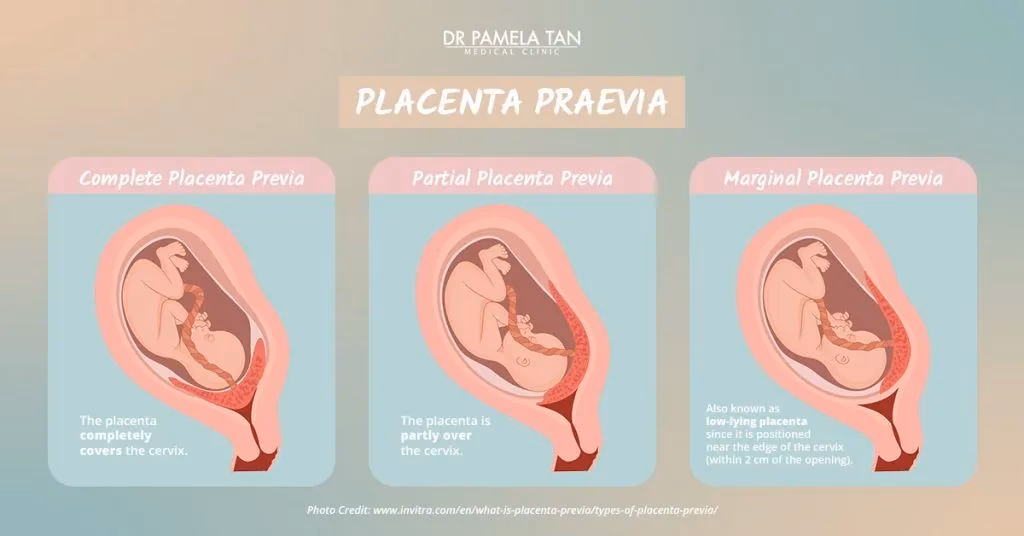 How can I increase my placenta naturally?