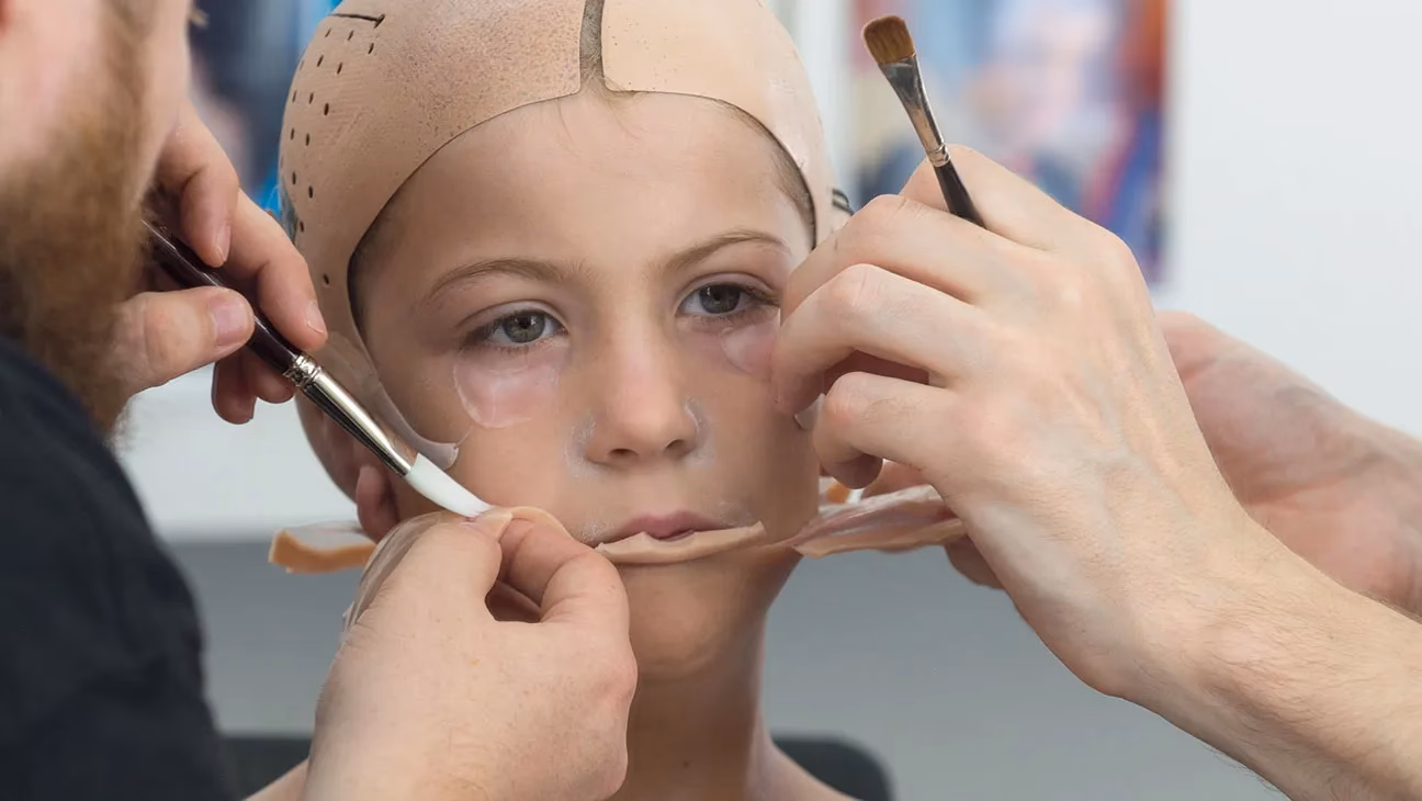 How did Auggie's face get messed up?