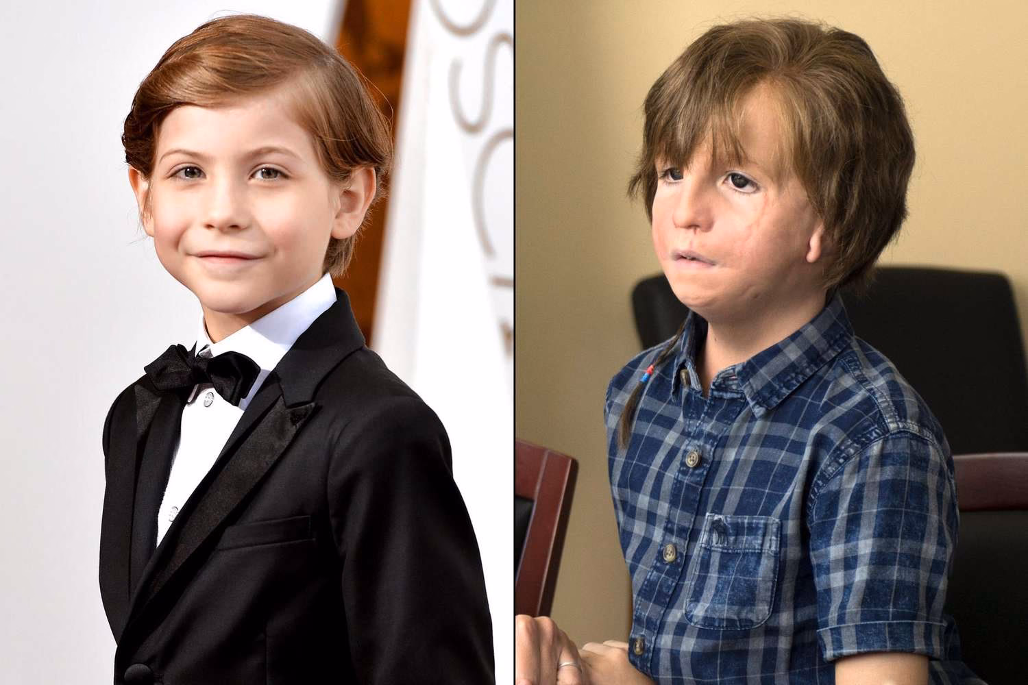 Does the actor for Auggie in Wonder actually look like that?