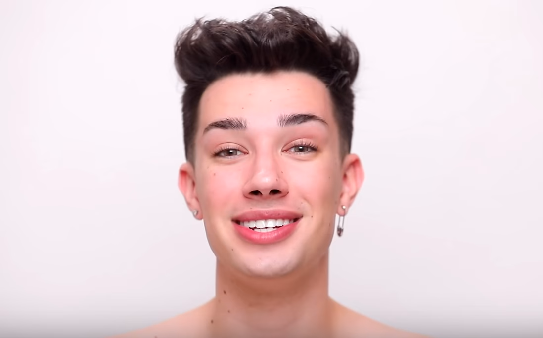 Does James Charles have lip fillers?
