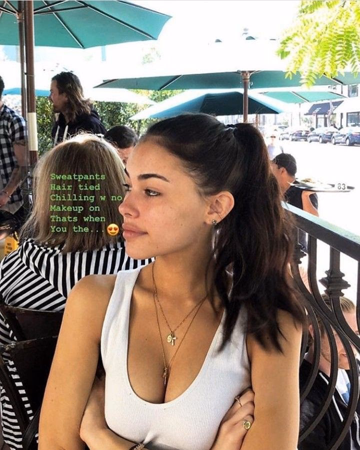 Does Madison Beer have fillers?