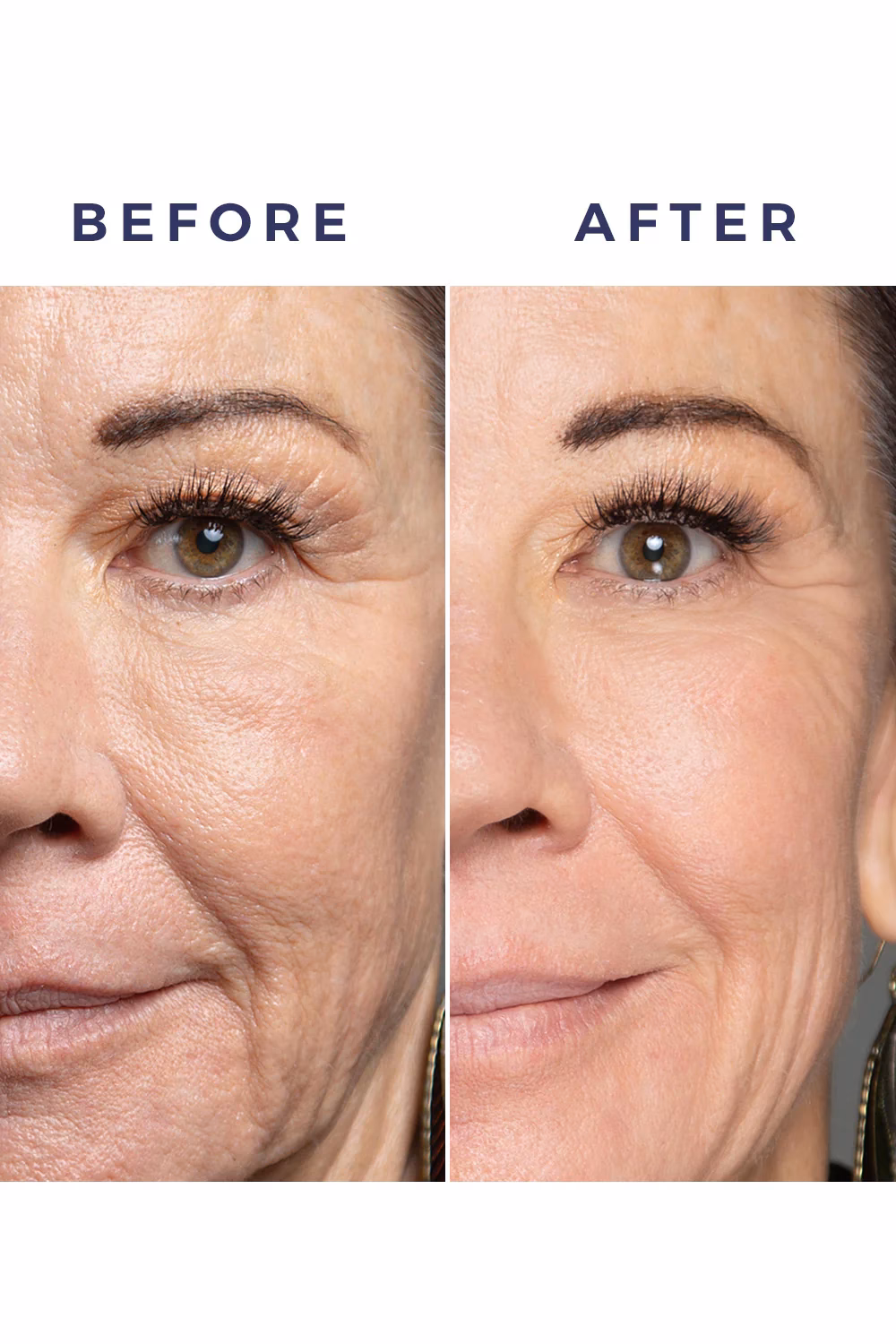 What is the best thing to put on your face for aging?