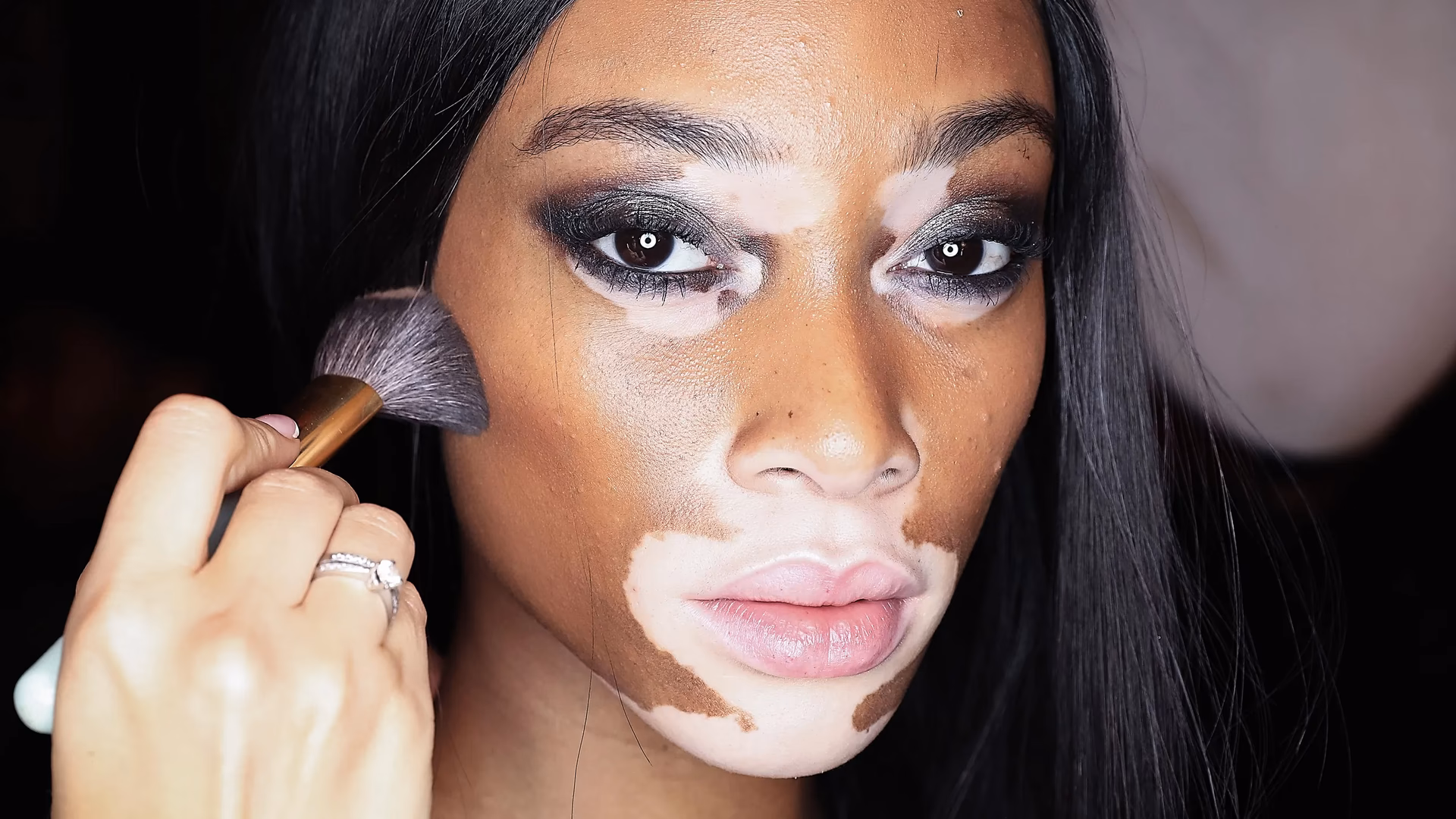 Can makeup trigger vitiligo?