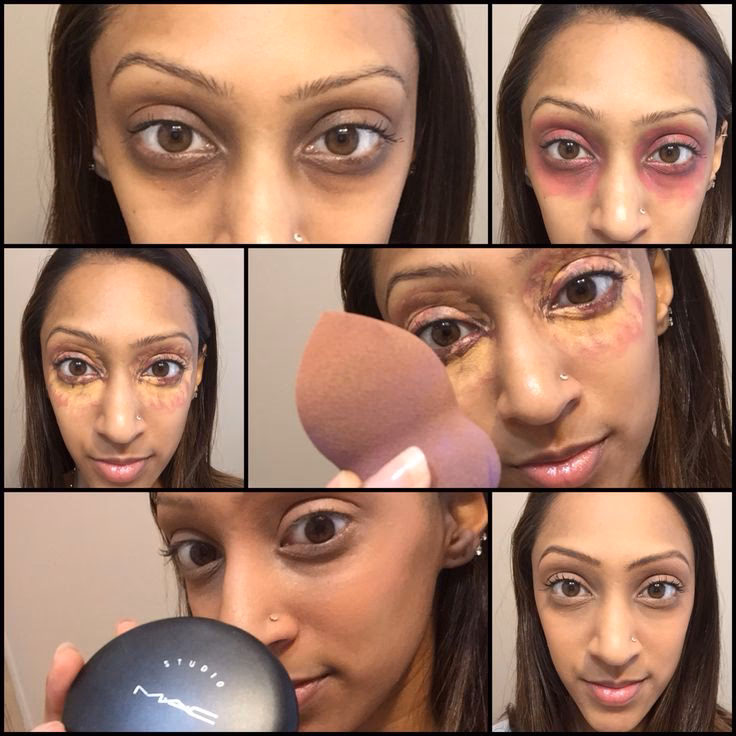 What makeup gets rid of dark circles?