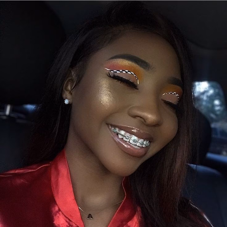 How to still look good with braces?