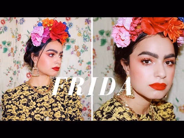 What did Frida Kahlo get diagnosed with?