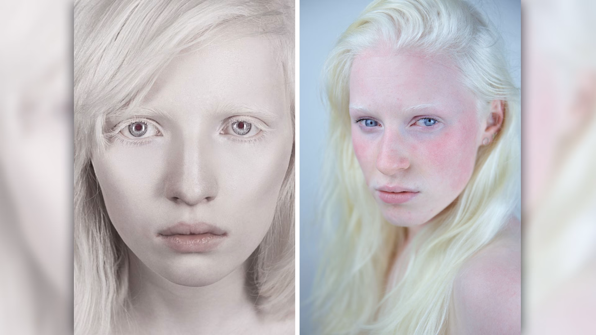 ¿Pueden los albinos usar maquillaje?