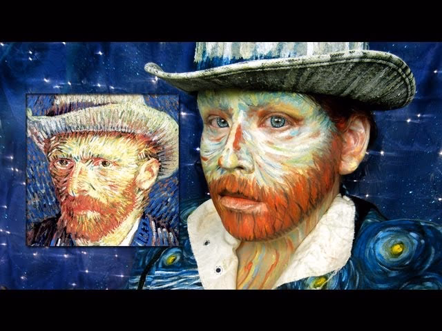 What syndrome did Vincent van Gogh have?