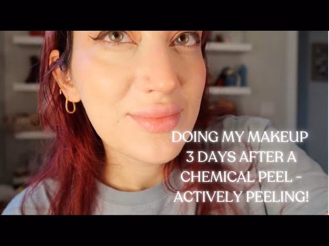 When can I start using products after a chemical peel?