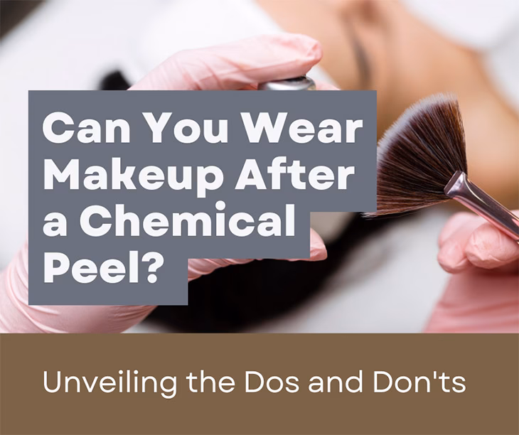 What should you not do after a chemical peel?