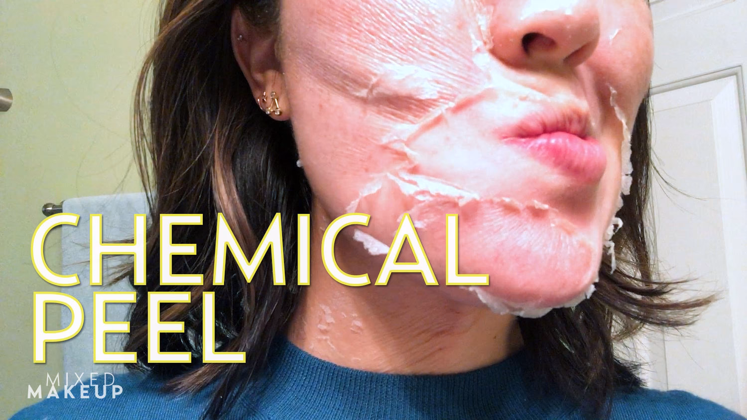 What should you not do after a chemical peel?