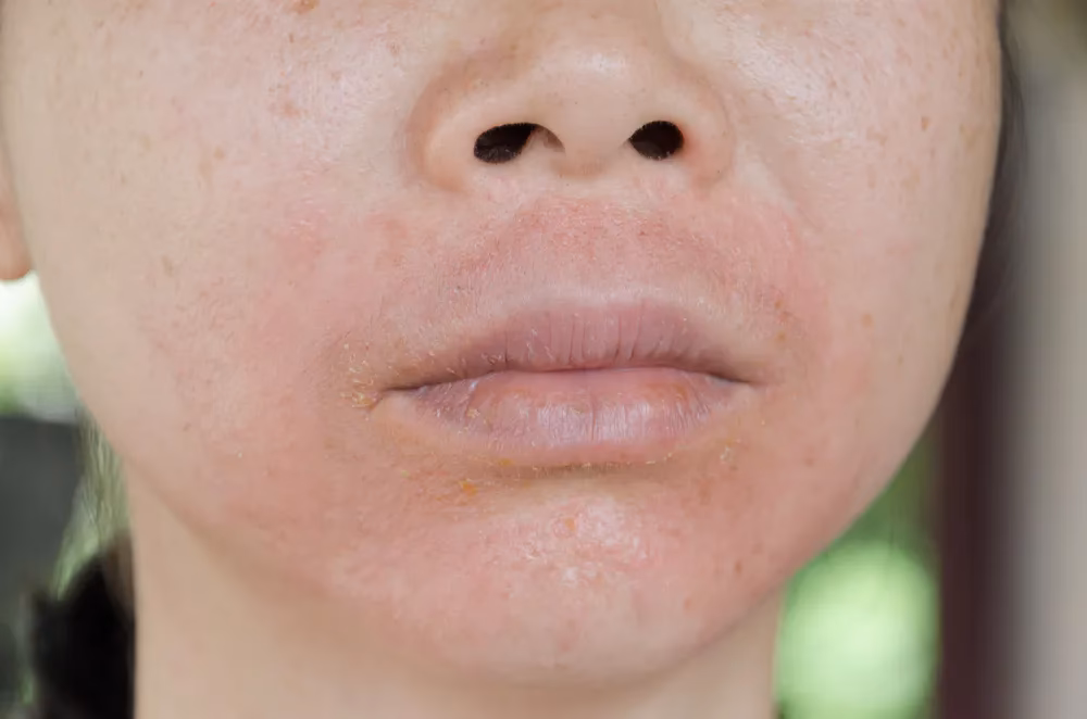 How to wear makeup without damaging your skin?